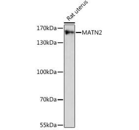 Western Blot - Anti-Matrilin 2 Antibody (A91648) - Antibodies.com