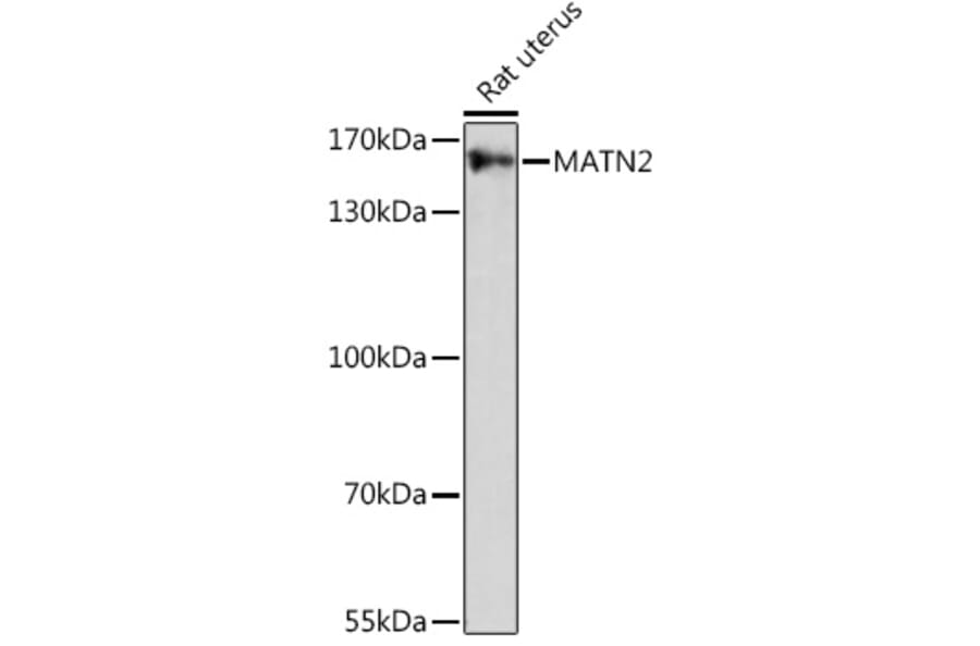 Western Blot - Anti-Matrilin 2 Antibody (A91648) - Antibodies.com
