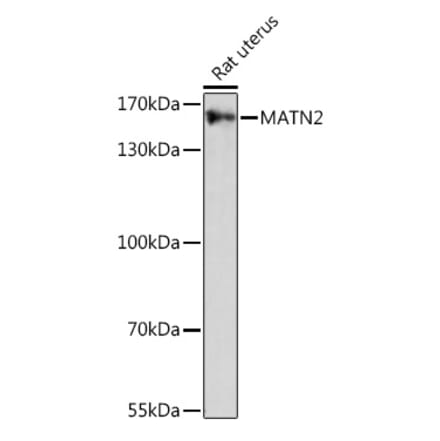 Western Blot - Anti-Matrilin 2 Antibody (A91648) - Antibodies.com