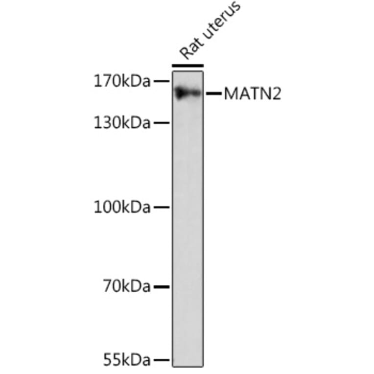 Western Blot - Anti-Matrilin 2 Antibody (A91648) - Antibodies.com