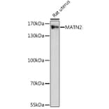 Western Blot - Anti-Matrilin 2 Antibody (A91648) - Antibodies.com