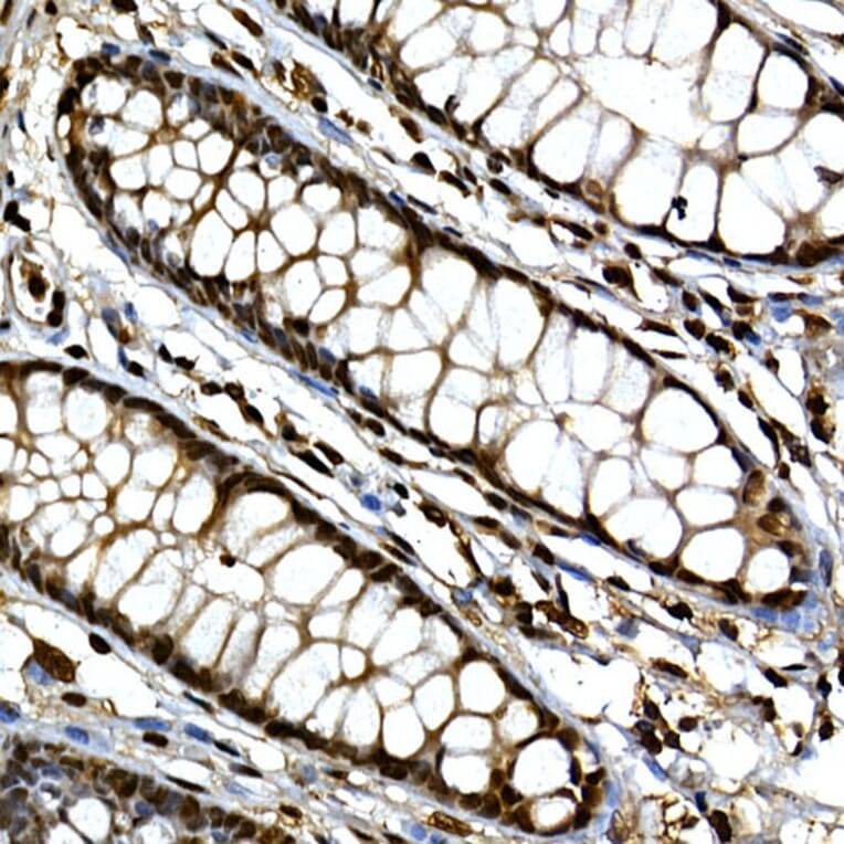 Immunohistochemistry - Anti-Gli3 Antibody (A91649) - Antibodies.com