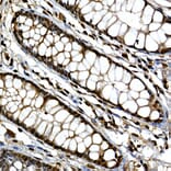 Immunohistochemistry - Anti-Gli3 Antibody (A91649) - Antibodies.com