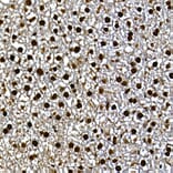 Immunohistochemistry - Anti-Gli3 Antibody (A91649) - Antibodies.com