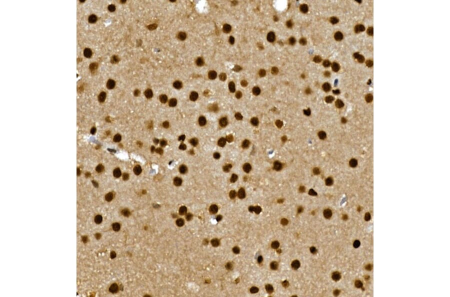 Immunohistochemistry - Anti-Gli3 Antibody (A91649) - Antibodies.com