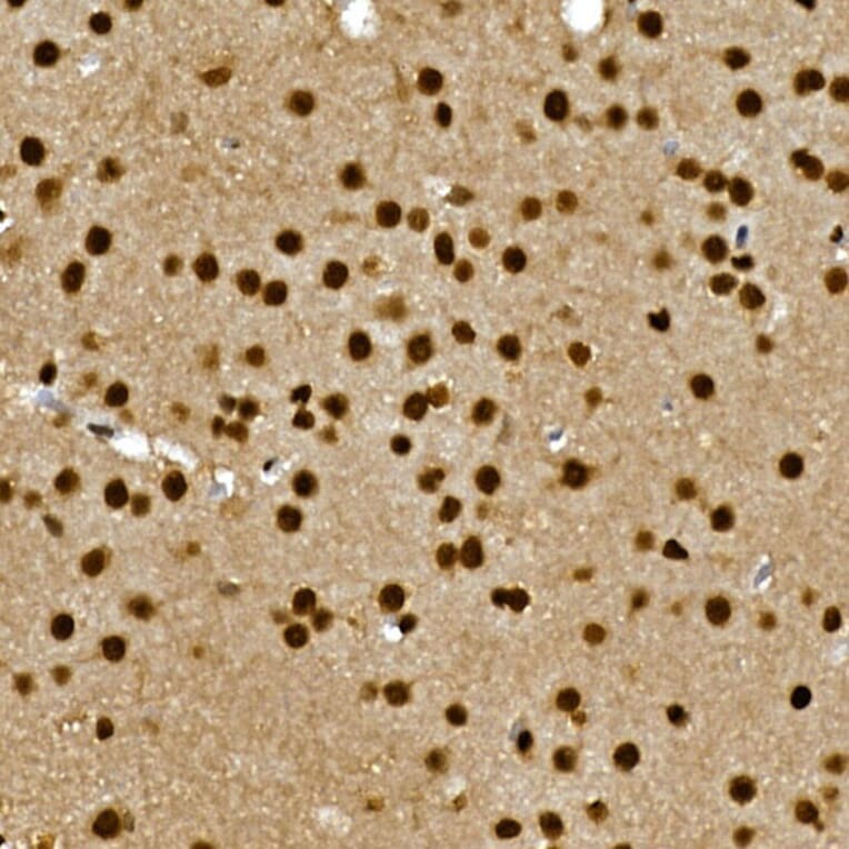 Immunohistochemistry - Anti-Gli3 Antibody (A91649) - Antibodies.com