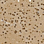 Immunohistochemistry - Anti-Gli3 Antibody (A91649) - Antibodies.com