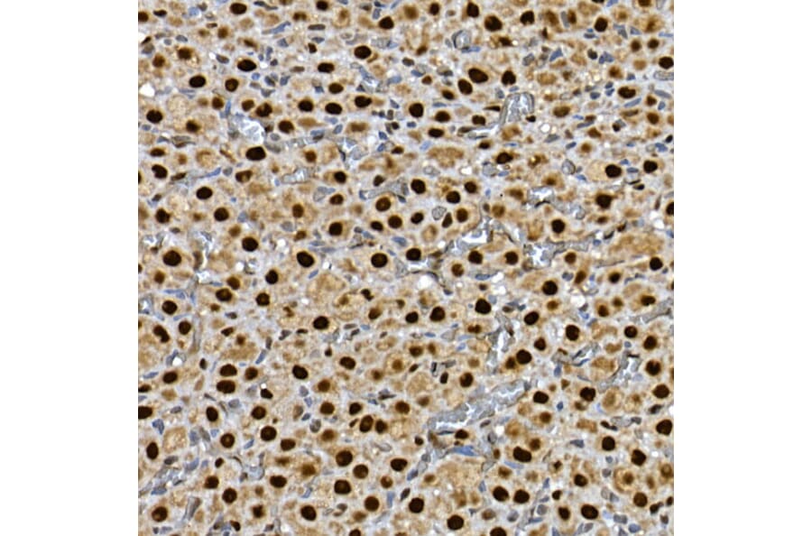 Immunohistochemistry - Anti-Gli3 Antibody (A91649) - Antibodies.com
