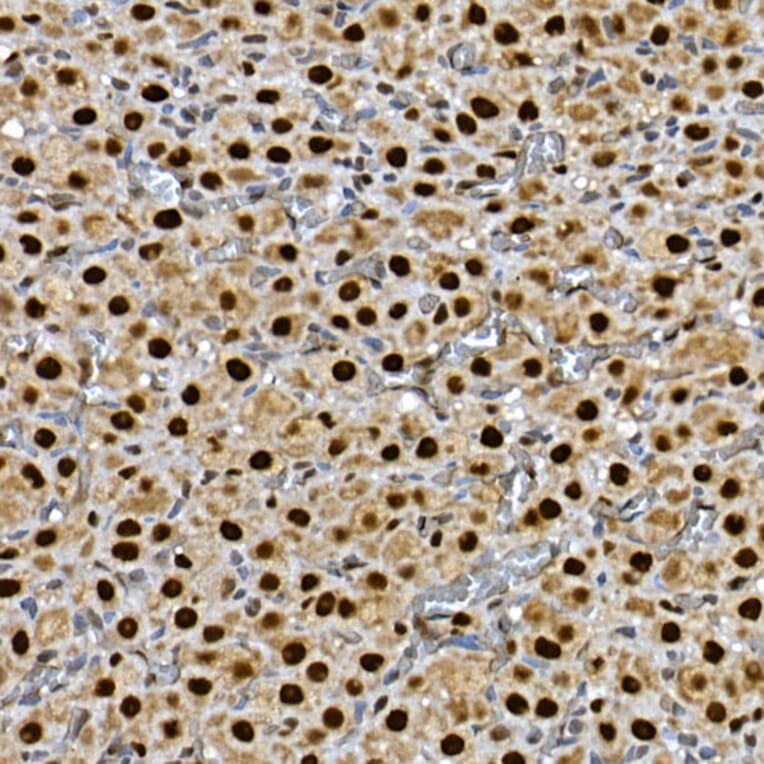 Immunohistochemistry - Anti-Gli3 Antibody (A91649) - Antibodies.com
