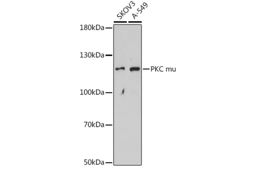 Western Blot - Anti-PKC mu/PKD Antibody (A91650) - Antibodies.com