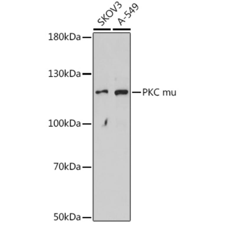 Western Blot - Anti-PKC mu/PKD Antibody (A91650) - Antibodies.com