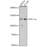 Western Blot - Anti-PKC mu/PKD Antibody (A91650) - Antibodies.com