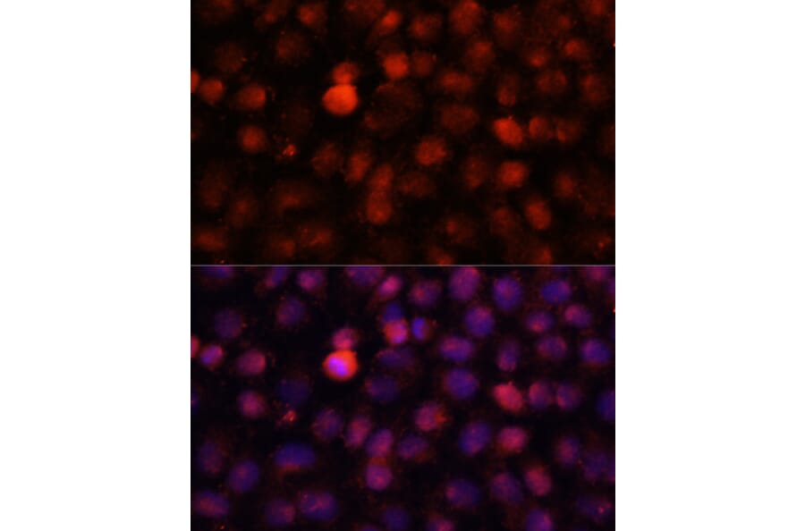 Immunofluorescence - Anti-N4-Methylcytidine Antibody (A15989) - Antibodies.com