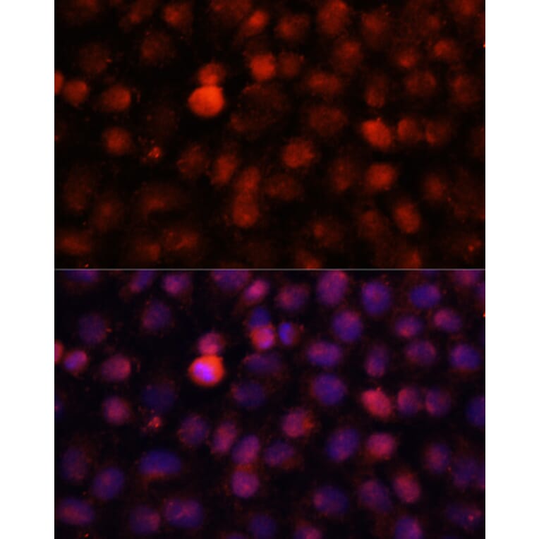 Immunofluorescence - Anti-N4-Methylcytidine Antibody (A15989) - Antibodies.com
