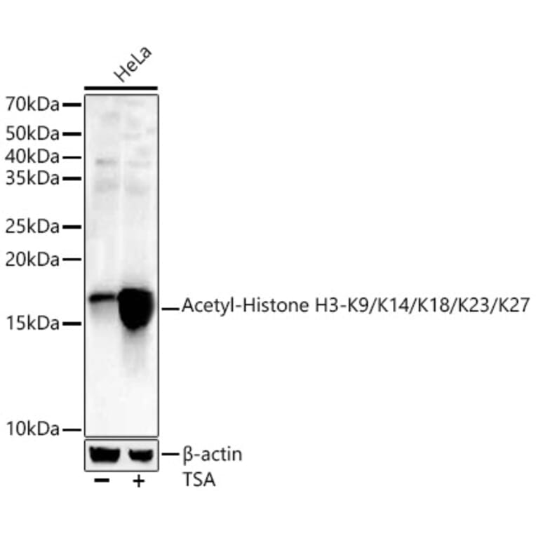 Western Blot - Anti-Histone H3 (acetyl Lys9 + Lys14 + Lys18 + Lys23 + Lys27) Antibody (A91654) - Antibodies.com