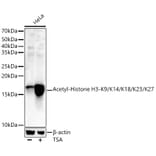 Western Blot - Anti-Histone H3 (acetyl Lys9 + Lys14 + Lys18 + Lys23 + Lys27) Antibody (A91654) - Antibodies.com