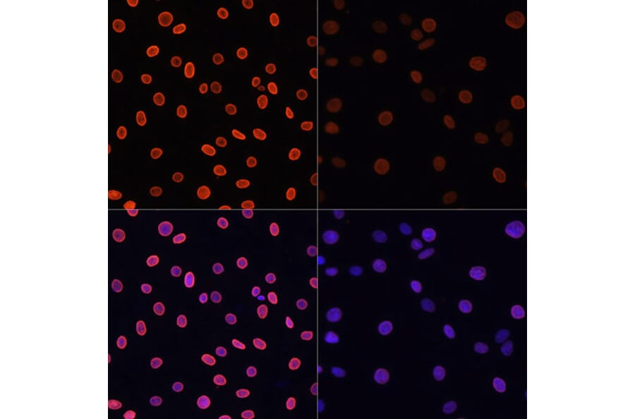 Immunofluorescence - Anti-Histone H4 (acetyl Lys91) Antibody (A91655) - Antibodies.com