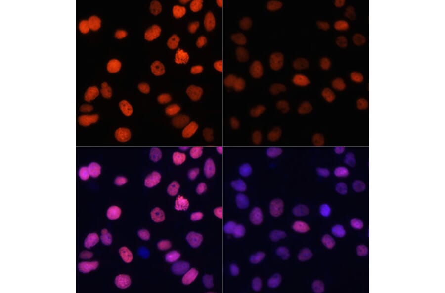Immunofluorescence - Anti-Histone H4 (acetyl Lys91) Antibody (A91655) - Antibodies.com