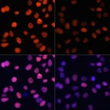 Immunofluorescence - Anti-Histone H4 (acetyl Lys91) Antibody (A91655) - Antibodies.com