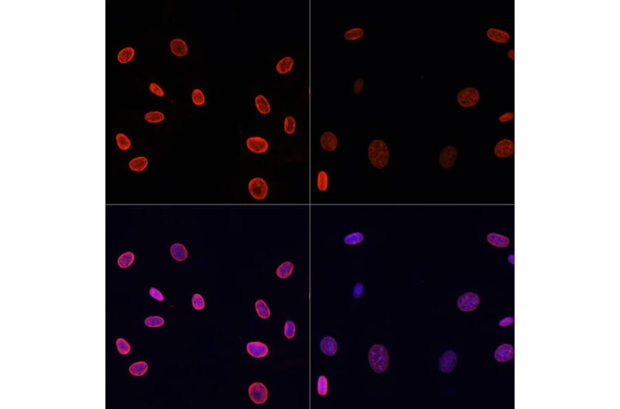 Immunofluorescence - Anti-Histone H4 (acetyl Lys91) Antibody (A91655) - Antibodies.com