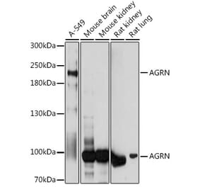 Western Blot - Anti-Agrin Antibody (A91657) - Antibodies.com