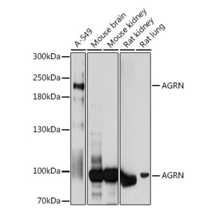 Western Blot - Anti-Agrin Antibody (A91657) - Antibodies.com