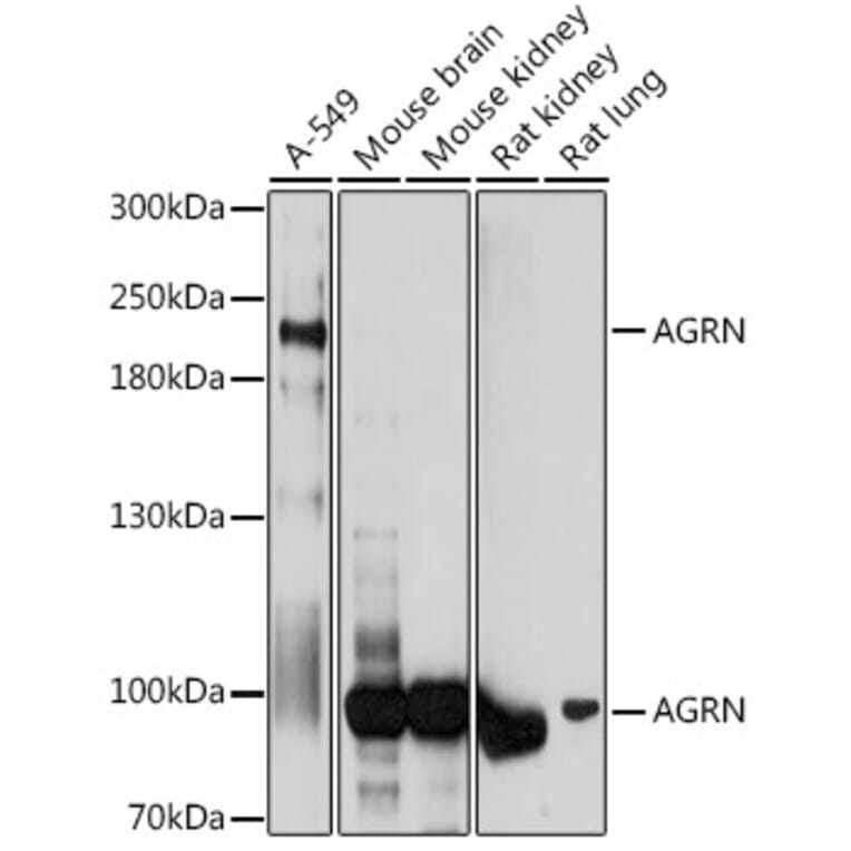 Western Blot - Anti-Agrin Antibody (A91657) - Antibodies.com