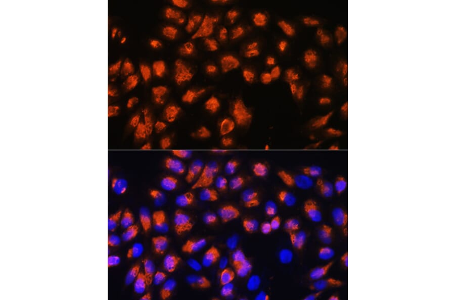 Immunofluorescence - Anti-Agrin Antibody (A91657) - Antibodies.com