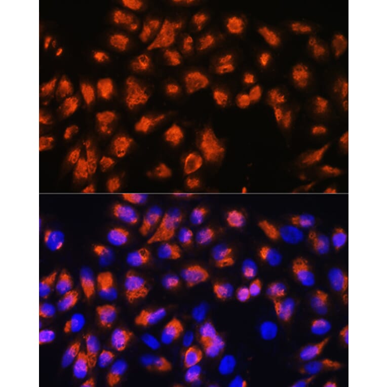 Immunofluorescence - Anti-Agrin Antibody (A91657) - Antibodies.com