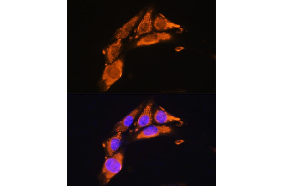 Immunofluorescence - Anti-Agrin Antibody (A91657) - Antibodies.com