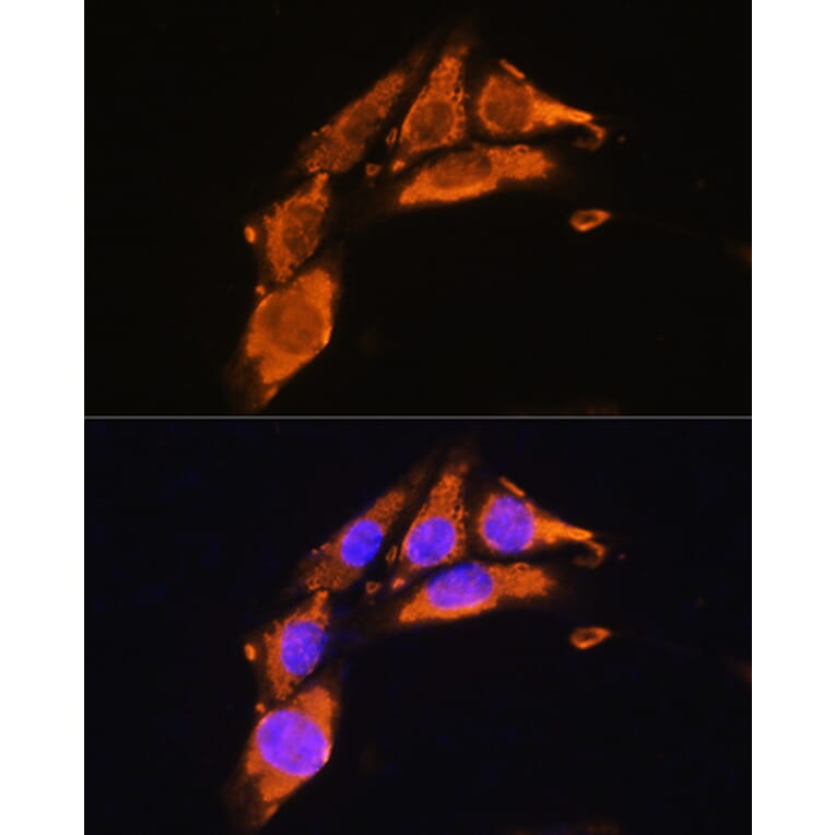 Immunofluorescence - Anti-Agrin Antibody (A91657) - Antibodies.com