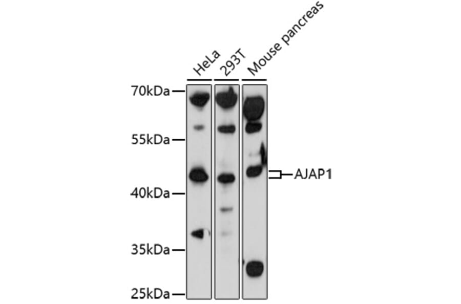 Western Blot - Anti-AJAP1 Antibody (A91658) - Antibodies.com