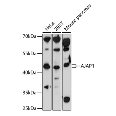 Western Blot - Anti-AJAP1 Antibody (A91658) - Antibodies.com