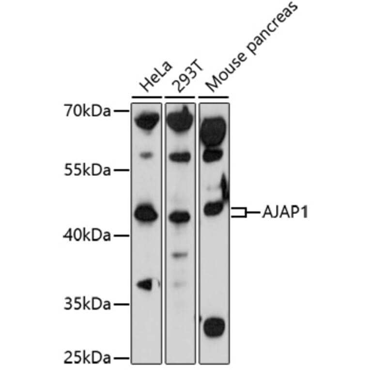 Western Blot - Anti-AJAP1 Antibody (A91658) - Antibodies.com