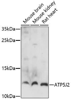 Western blot analysis of extracts of various cell lines, using Anti-ATP5J2 Antibody (A17055) at 1:1,000 dilution.
Secondary antibody: Goat Anti-Rabbit IgG (H+L) (HRP) (AS014) at 1:10,000 dilution.
Lysates / proteins: 25µg per lane.
Blocking buffer: 3% non-fat dry milk in TBST.
Detection: ECL Basic Kit (RM00020).
Exposure time: 90s.