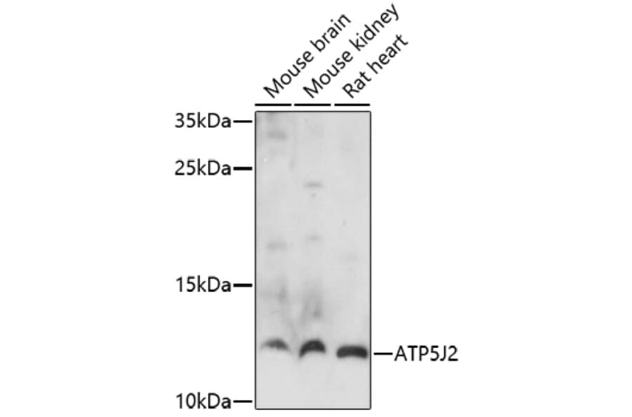 Western Blot - Anti-ATP5J2 Antibody (A91663) - Antibodies.com