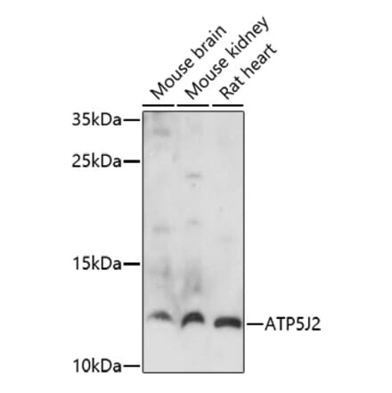 Western Blot - Anti-ATP5J2 Antibody (A91663) - Antibodies.com