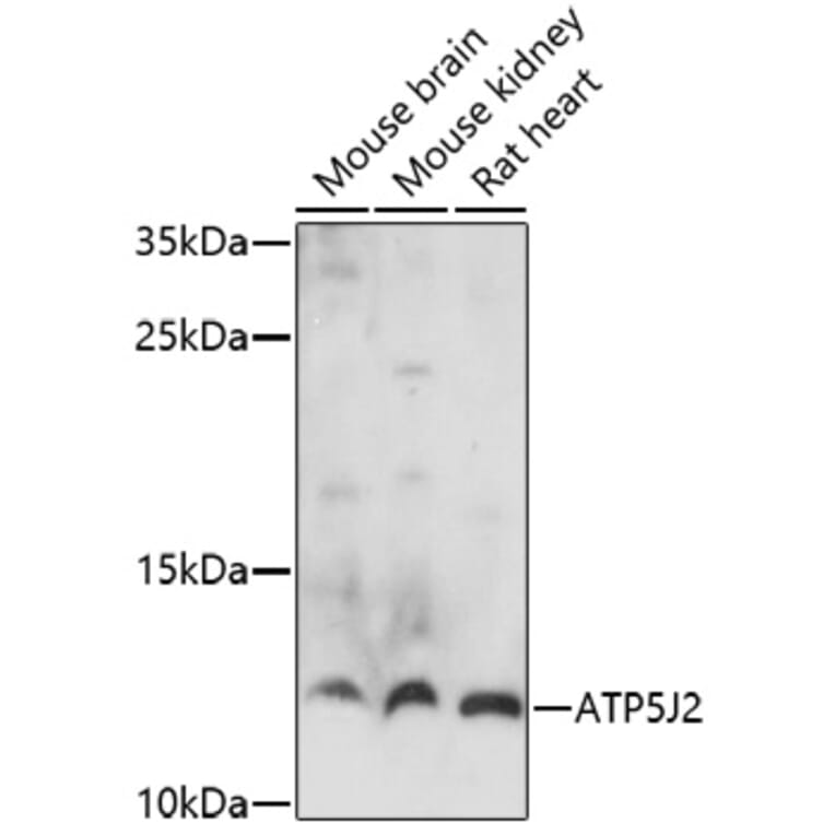 Western Blot - Anti-ATP5J2 Antibody (A91663) - Antibodies.com