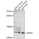 Western Blot - Anti-ATP5J2 Antibody (A91663) - Antibodies.com