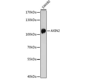 Western Blot - Anti-Axin 2 Antibody (A91664) - Antibodies.com