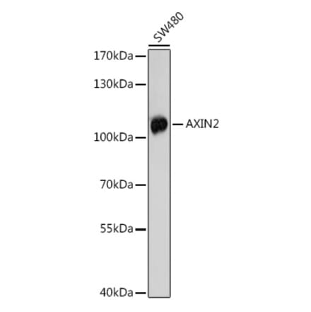 Western Blot - Anti-Axin 2 Antibody (A91664) - Antibodies.com