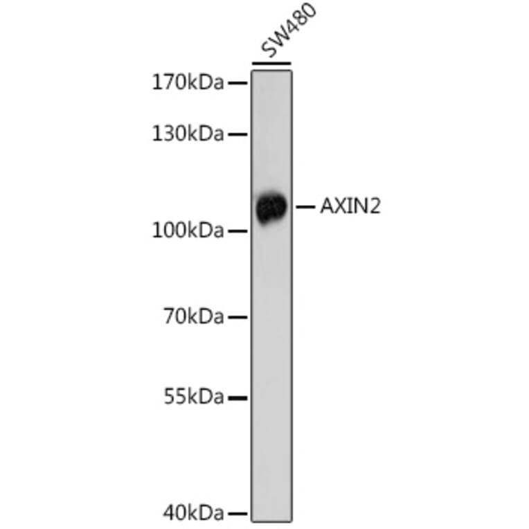 Western Blot - Anti-Axin 2 Antibody (A91664) - Antibodies.com