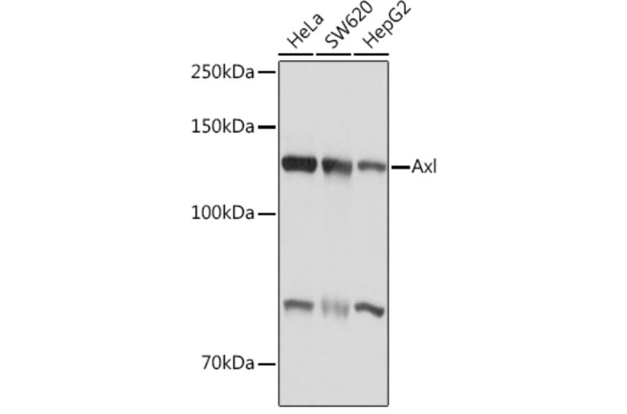 Western Blot - Anti-Axl Antibody (A91665) - Antibodies.com