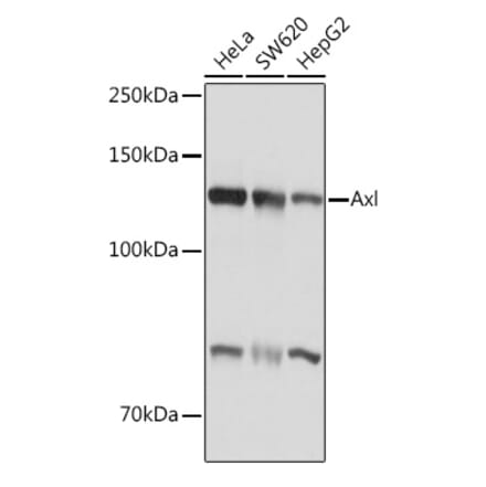 Western Blot - Anti-Axl Antibody (A91665) - Antibodies.com