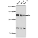 Western Blot - Anti-Axl Antibody (A91665) - Antibodies.com