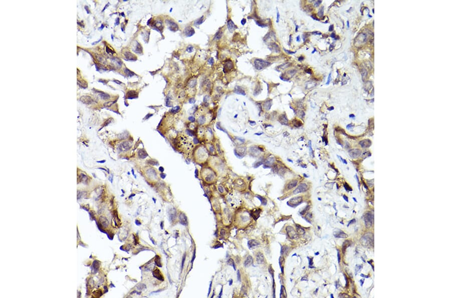 Immunohistochemistry - Anti-Axl Antibody (A91665) - Antibodies.com
