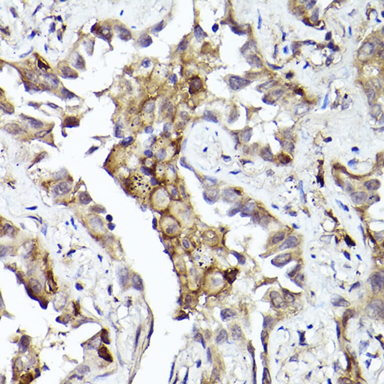 Immunohistochemistry - Anti-Axl Antibody (A91665) - Antibodies.com