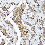 Immunohistochemistry - Anti-Axl Antibody (A91665) - Antibodies.com