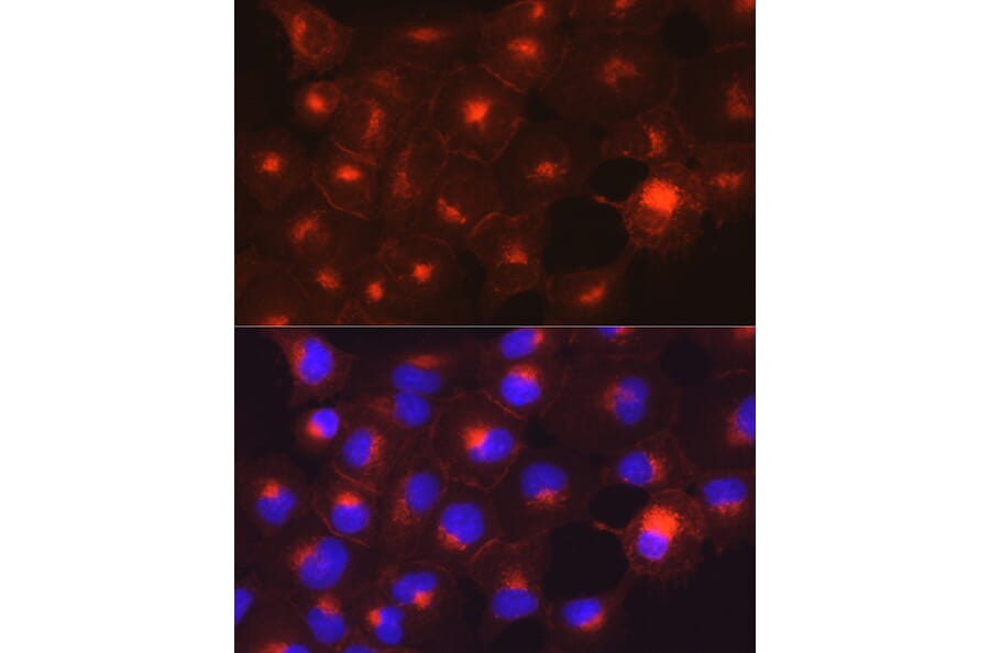 Immunofluorescence - Anti-Axl Antibody (A91665) - Antibodies.com
