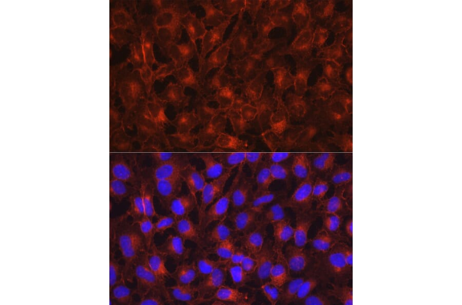 Immunofluorescence - Anti-Axl Antibody (A91665) - Antibodies.com